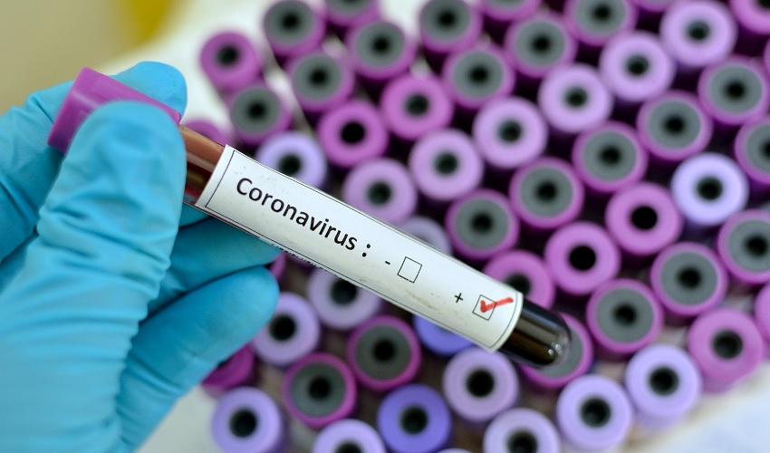 Coronavirus: l'appello dei rettori lombardi